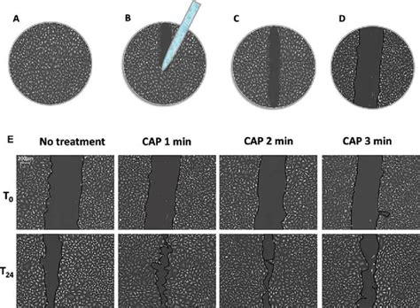 scratch wound healing assay protocol